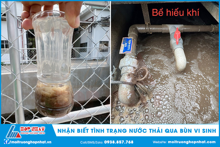 Nhận biết tình trạng nước thải qua bùn vi sinh